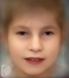 DYRK1A Syndrome OMIM# 614104 - FDNA